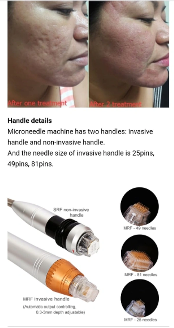 Nubway Laser Machine